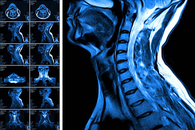 mri